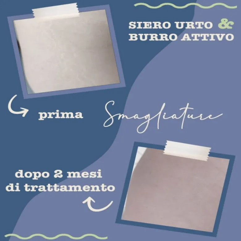 Burro attivo Smagliature
