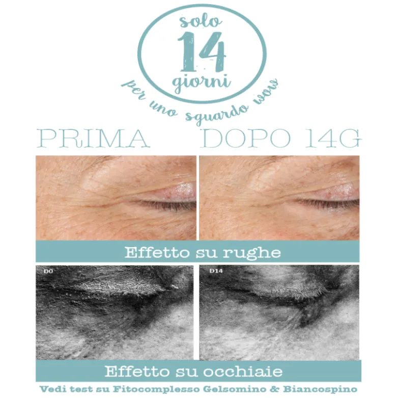 Crema contorno occhi 3 in 1