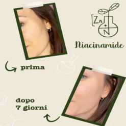 Niacinamide + Zinco