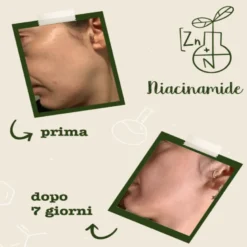 Niacinamide + Zinco