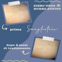 Siero Urto Smagliature