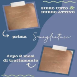 Trattamento smagliature